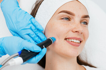 Microdermabrasion